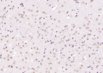 Phospho-CK II beta (Ser209) Rabbit Polyclonal Antibody
