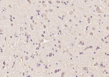 AOC1 Rabbit Polyclonal Antibody