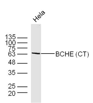 Butyrylcholinesterase Rabbit Polyclonal Antibody