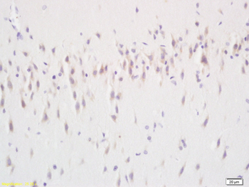 Phospho-NRP1 (Thr916) Rabbit Polyclonal Antibody