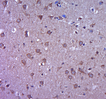MMP-2 Rabbit Polyclonal Antibody
