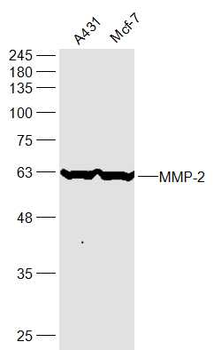 MMP-2 Rabbit Polyclonal Antibody