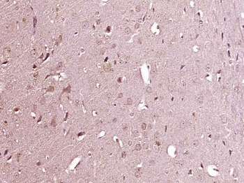 CXCL13/BCA1 Rabbit Polyclonal Antibody