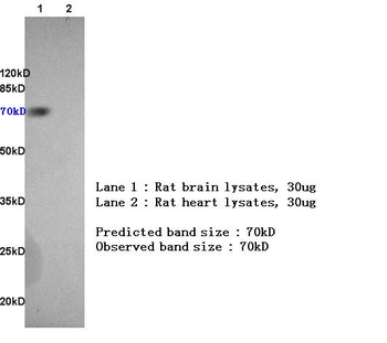 CD105 Rabbit Polyclonal Antibody