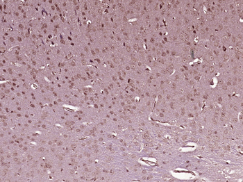 NCOA3 Rabbit Polyclonal Antibody