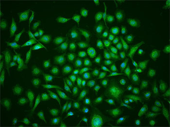 Galectin 7 Rabbit Polyclonal Antibody