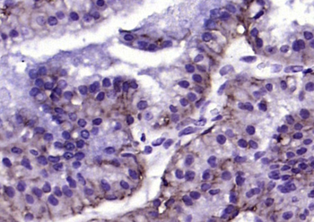 EpCAM Rabbit Polyclonal Antibody