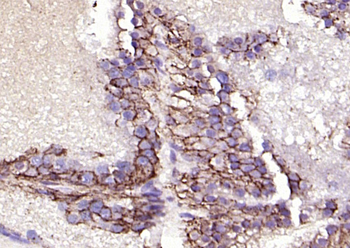 EpCAM Rabbit Polyclonal Antibody