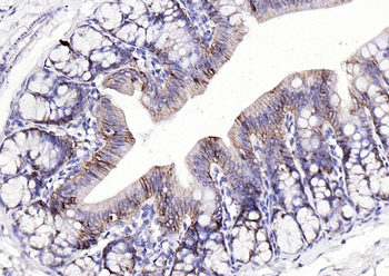 EpCAM Rabbit Polyclonal Antibody