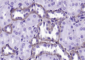 EpCAM Rabbit Polyclonal Antibody