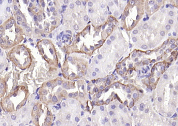 EpCAM Rabbit Polyclonal Antibody