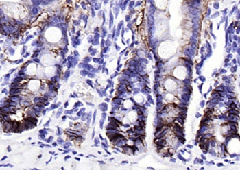 EpCAM Rabbit Polyclonal Antibody