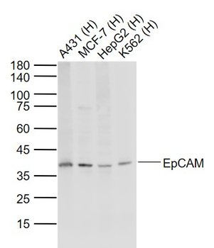 EpCAM Rabbit Polyclonal Antibody