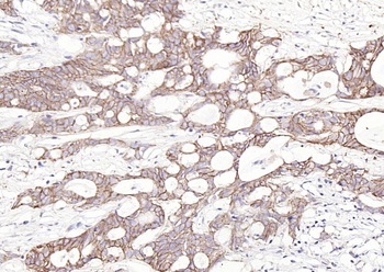EpCAM Rabbit Polyclonal Antibody