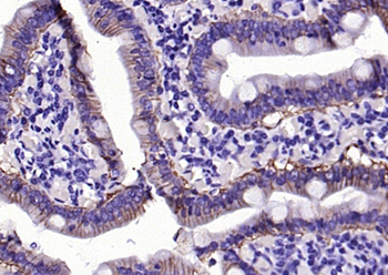 EpCAM Rabbit Polyclonal Antibody