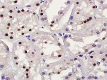 RNF56 Rabbit Polyclonal Antibody