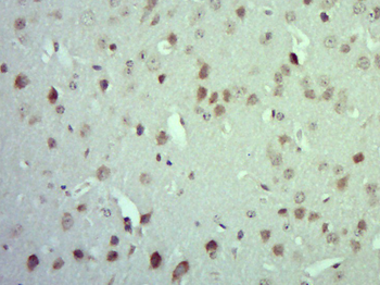 MARK4 Rabbit Polyclonal Antibody