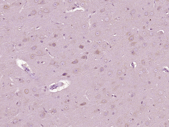 G21 protein/NPR2L Rabbit Polyclonal Antibody