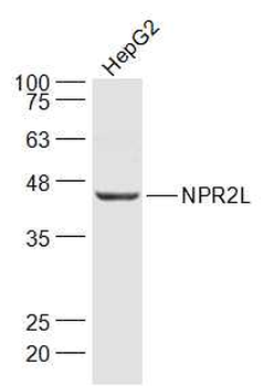 G21 protein/NPR2L Rabbit Polyclonal Antibody