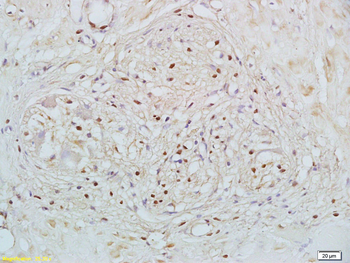 RXR beta Rabbit Polyclonal Antibody