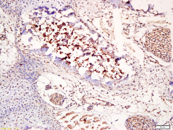 Osteocalcin Rabbit Polyclonal Antibody