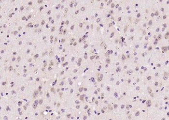 DNAJB6 Rabbit Polyclonal Antibody