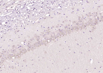 DNAJB6 Rabbit Polyclonal Antibody