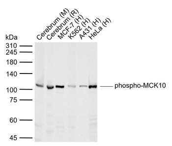 Phospho-DDR1 (Tyr513) Rabbit Polyclonal Antibody