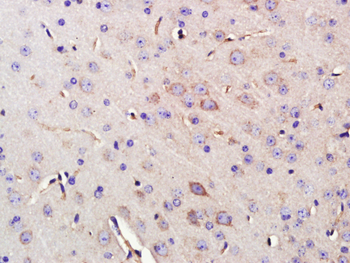 ENPP2 Rabbit Polyclonal Antibody