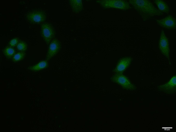 Bid Rabbit Polyclonal Antibody