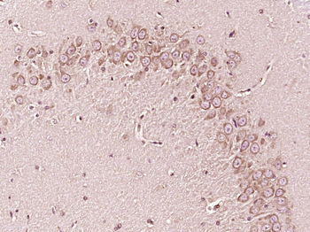 Bid Rabbit Polyclonal Antibody