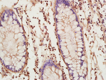 Phospho-EZH2 (Thr487) Rabbit Polyclonal Antibody
