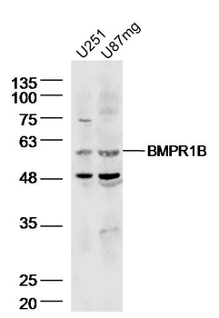 BMPR1B Rabbit Polyclonal Antibody
