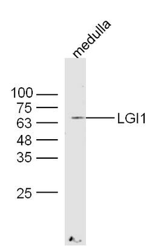 LGI1 Rabbit Polyclonal Antibody