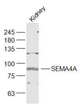 SEMA4A Rabbit Polyclonal Antibody