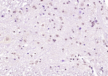 NTR3 Rabbit Polyclonal Antibody