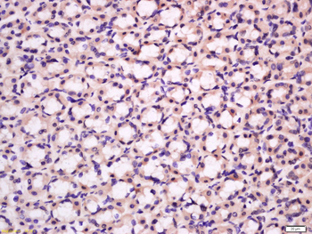 KCNMA1/BK channel Rabbit Polyclonal Antibody