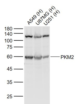 PKM2 Mouse Polyclonal Antibody