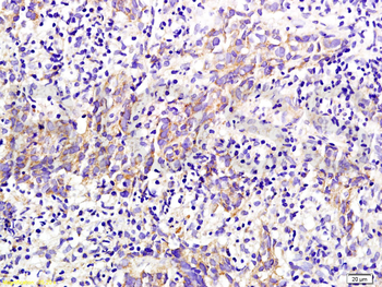 PKM2 Mouse Polyclonal Antibody