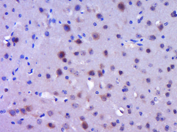 BMP2 Rabbit Polyclonal Antibody