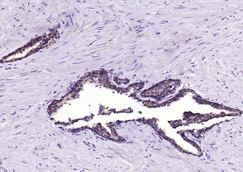 BMPR1A Rabbit Polyclonal Antibody