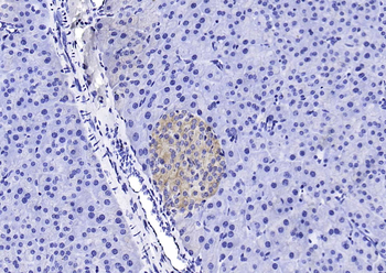 BMPR1A Rabbit Polyclonal Antibody