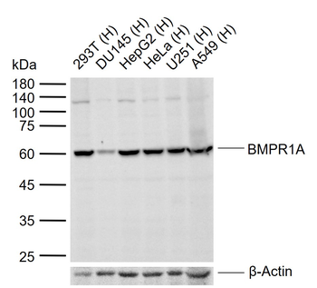 BMPR1A Rabbit Polyclonal Antibody