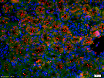 BNP Rabbit Polyclonal Antibody