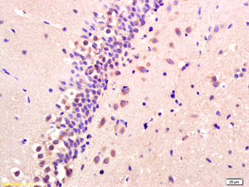 BNP Rabbit Polyclonal Antibody