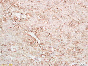 BNP Rabbit Polyclonal Antibody