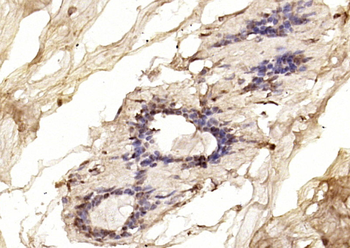 BRCA1 Rabbit Polyclonal Antibody