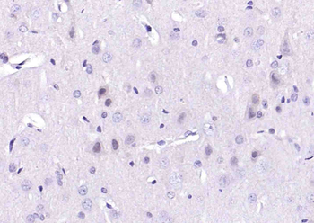 BRCA2 Rabbit Polyclonal Antibody