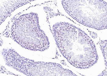 BRCA2 Rabbit Polyclonal Antibody