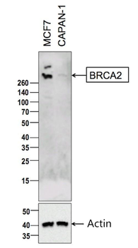 BRCA2 Rabbit Polyclonal Antibody